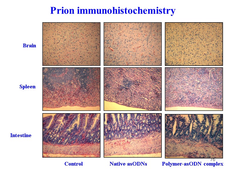 76 Prion immunohistochemistry Brain Spleen Intestine Control Native asODNs Polymer-asODN complex